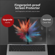 Macbook Screen protector|Lention.com